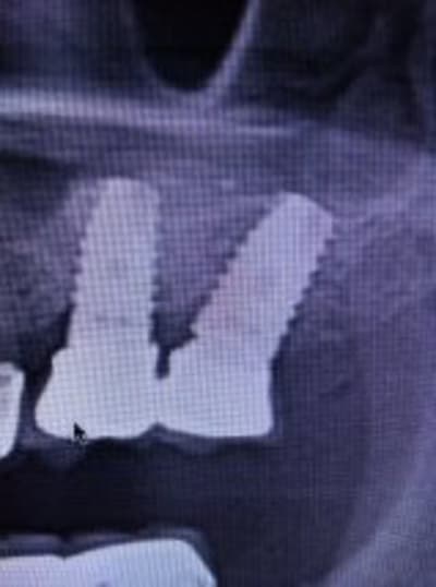 Getattachment rahteh - Eugenol