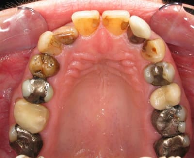 Haut  custom  trm9o4 - Eugenol