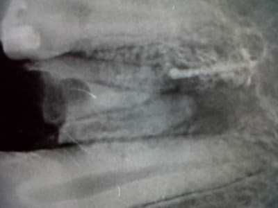 Img00356 20120214 2013 jmln0w - Eugenol