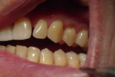 Imgp1350 zhiajo - Eugenol