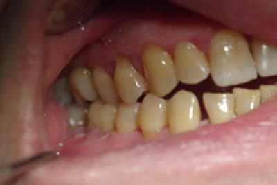 Imgp1355 lusff6 - Eugenol