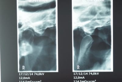 Imgp1403 cxt9lr - Eugenol