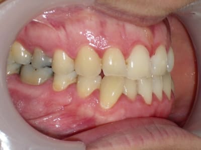 Imgp8146 huuf7s - Eugenol