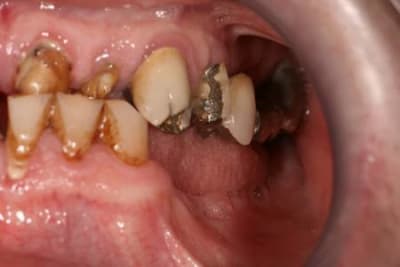 Img 0015 s85ysb - Eugenol