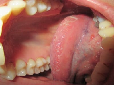 Img 0040 jgfcef - Eugenol