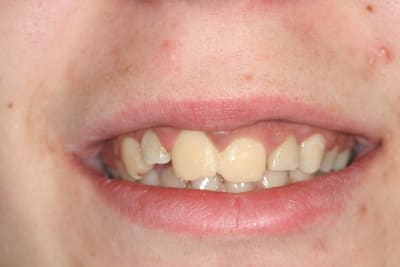 Img 0044 ygpyho - Eugenol