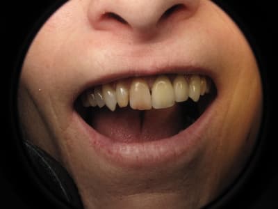 Img 0053 ld8rww - Eugenol