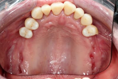 Img 0060 td1gzb - Eugenol