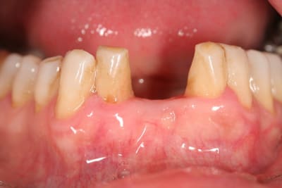 Img 0066 bpmgnj - Eugenol