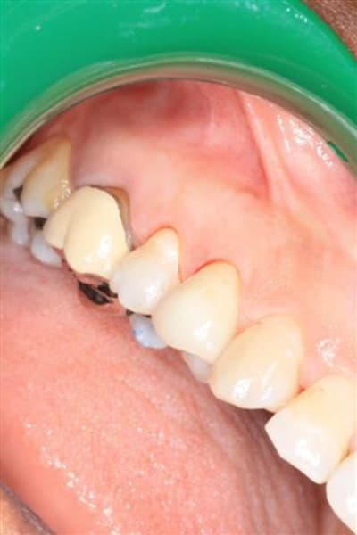 Img 0103  small  nzuevu - Eugenol