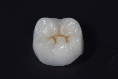 Img 0123 pl9j4e - Eugenol