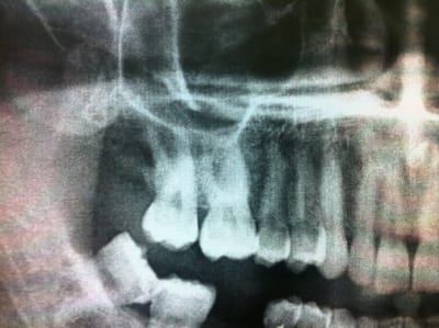 Img 0124 kbjynj - Eugenol