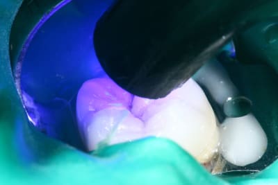 Img 0129 zmylc6 - Eugenol