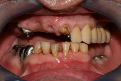 Img 0151 vyloix - Eugenol