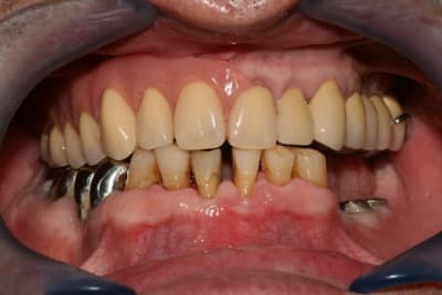 Img 0153 j5r4ue - Eugenol