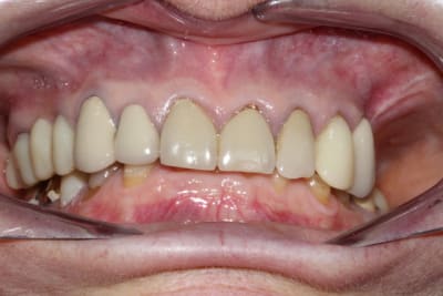 Img 0215 nsmdpb - Eugenol