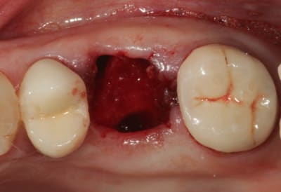 Img 0219 wsv6jk - Eugenol