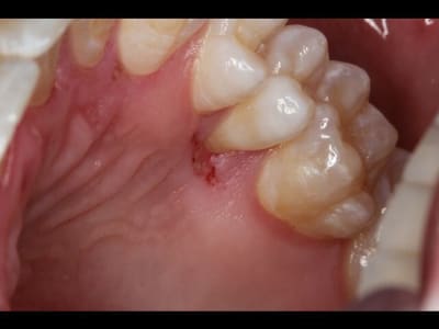 Img 0232 640x480 egsdmv - Eugenol