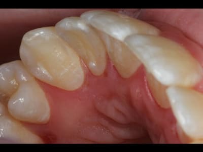 Img 0236 640x480 evixg6 - Eugenol