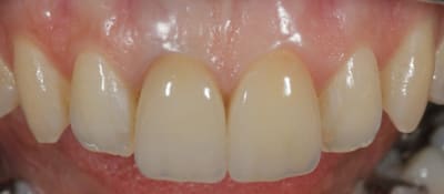 Img 0256 sqiq5j - Eugenol