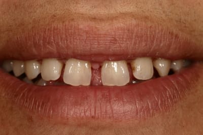 Img 0277 gytx8l - Eugenol