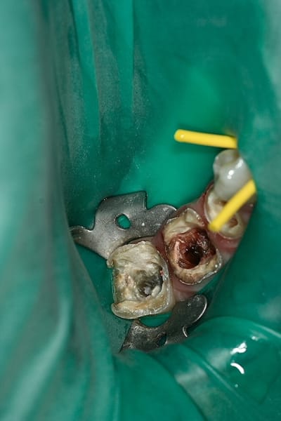 Img 0280 iy7zl0 - Eugenol