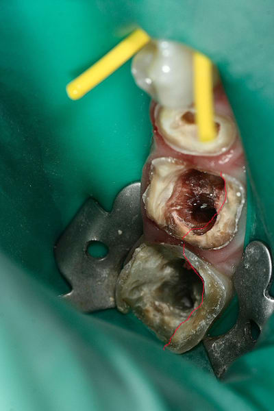 Img 0281 teovk0 - Eugenol