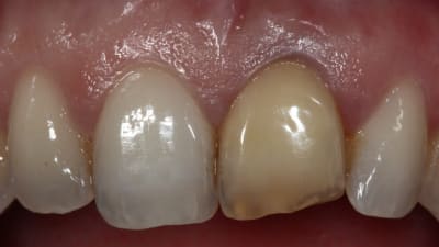 Img 0371 hgaxmi - Eugenol