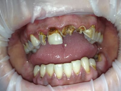 Img 0426 ixiy3t - Eugenol
