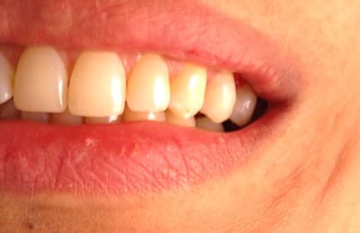 Img 0441 kuncu9 - Eugenol