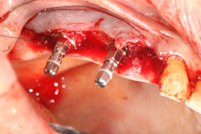 Img 0471 r65aww - Eugenol