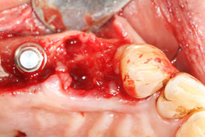 Img 0473 pqgnuy - Eugenol