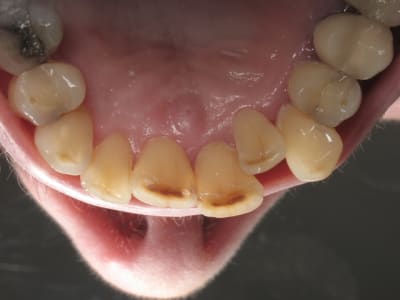 Img 0480 n6xxon - Eugenol