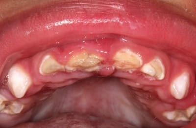 Img 0488 go9thr - Eugenol