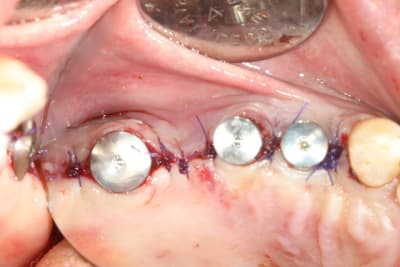 Img 0488 ztcw6v - Eugenol