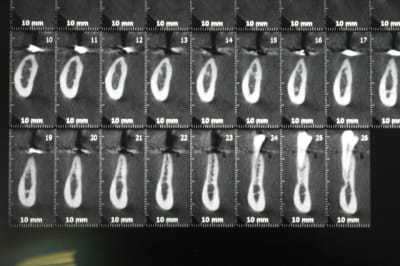 Img 0574 m6216u - Eugenol