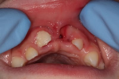 Img 0634 mbsmgg - Eugenol