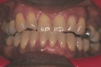 Img 0659 ilx9u6 - Eugenol