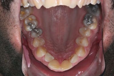 Img 0685 v9q8vg - Eugenol