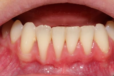 Img 0737 ztomwi - Eugenol