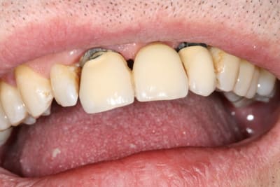 Img 0789 q41utf - Eugenol