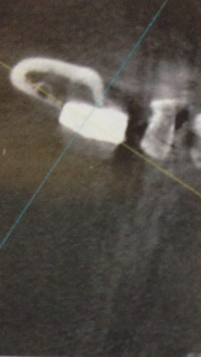 Img 0792 gpk5jo - Eugenol