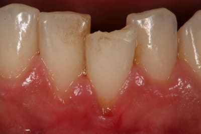 Img 0817 x88tgc - Eugenol