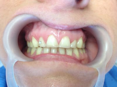 Img 0842 s5msvg - Eugenol