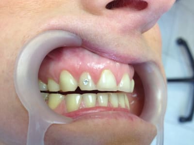 Img 0845 hcjlsf - Eugenol