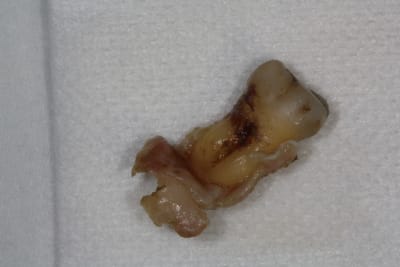 Img 0865 zjsu8u - Eugenol