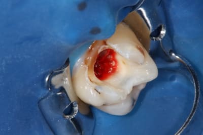 Img 0869 hpopx9 - Eugenol