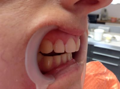 Img 0877 znkg9z - Eugenol