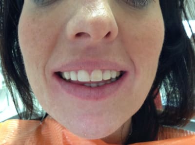 Img 0882 v6z8eh - Eugenol