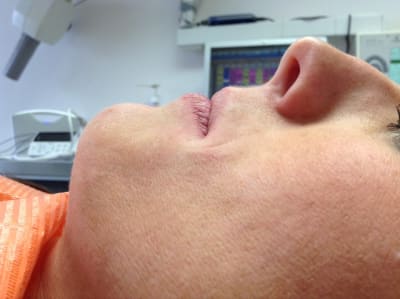 Img 0891 e5clyp - Eugenol